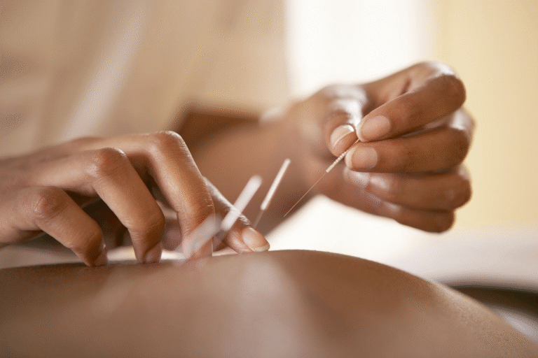 Surprising Benefits of Acupuncture Surprising Benefits of Acupuncture